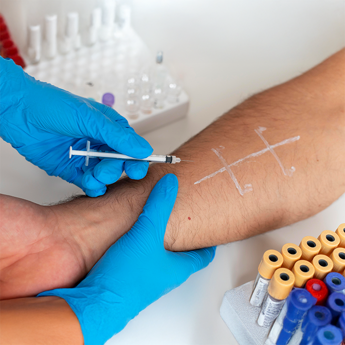 ΕΛΕΓΧΟΣ ΘΡΟΜΒΟΦΙΛΙΑΣ